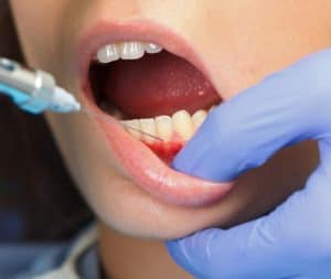 טיפולי שיניים בהרדמה כללית